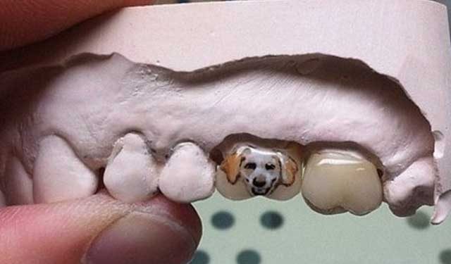 Dişte yeni trend: Diş dövmesi