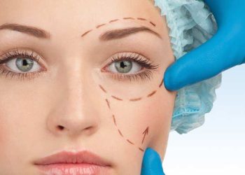 Oküloplasti nedir?