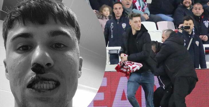 Sivas taraftarının burnunu kırdığı Bianco ameliyat olacak!