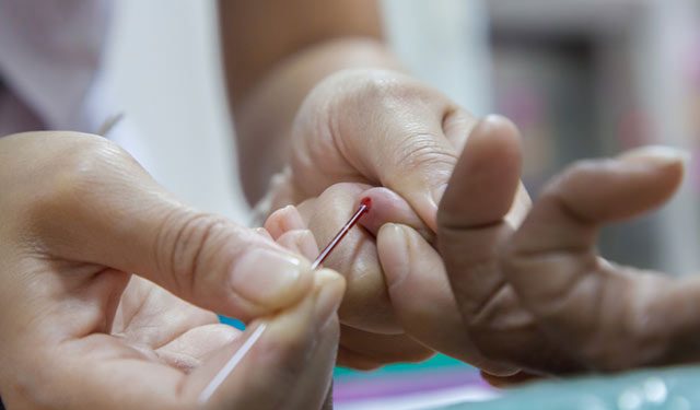 Talasemi hakkında doğru bilinen 10 yanlış