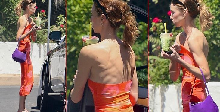 ‘Kocam çok zayıf olduğum için endişeli’ demişti! Ünlü oyuncunun kemikleri sayıldı