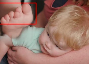 12 parmaklı doğdu, ortalık karıştı! ‘Fotoğrafına bakıp alay ettiler’