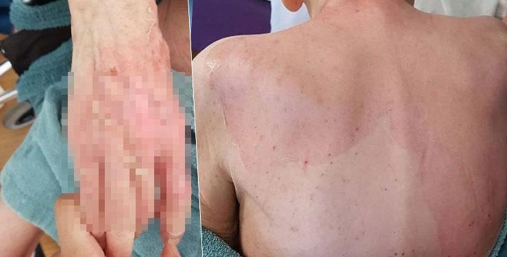 Huzurevinde ölüme götüren iddia! Beklenen rapor geldi